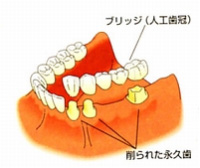 ブリッジのイメージ