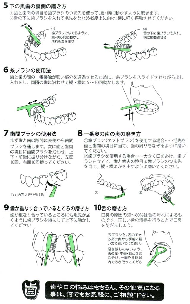 歯間ブラシで磨き残しなし