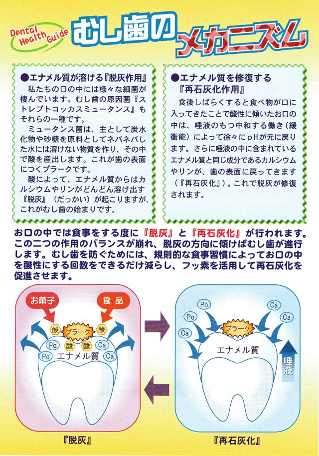 むし歯のメカニズム