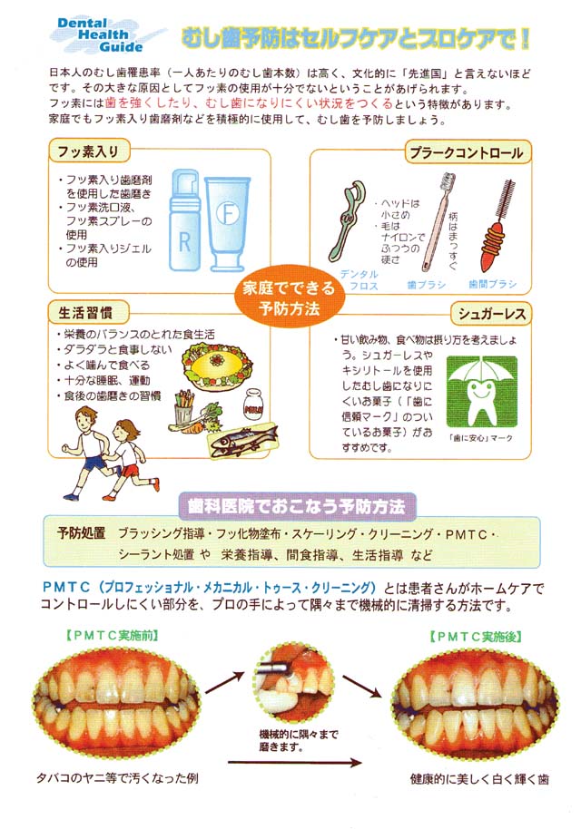 むし歯予防はセルフケアとプロケアで