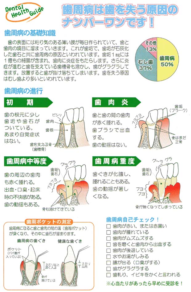 歯周病は歯を失う原因のナンバーワンです