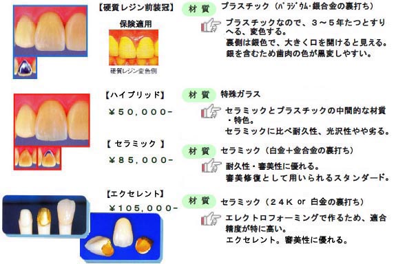 セラミック