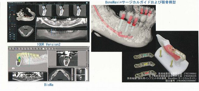 イメージ写真