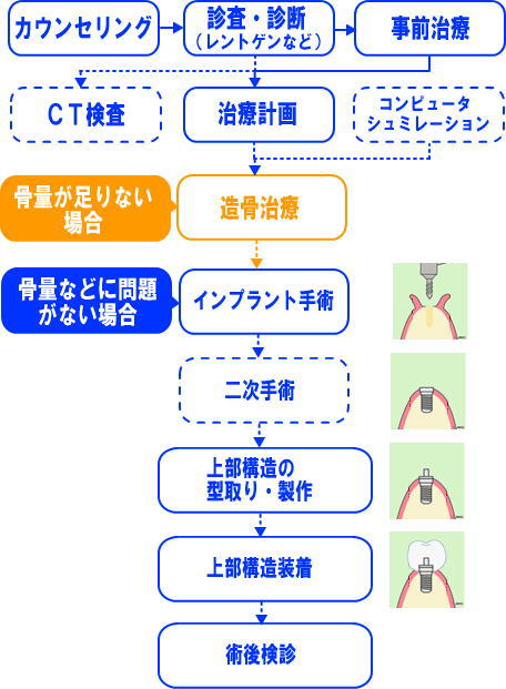 インプラント治療の流れ