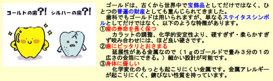 ゴールドの歯?シルバーの歯？