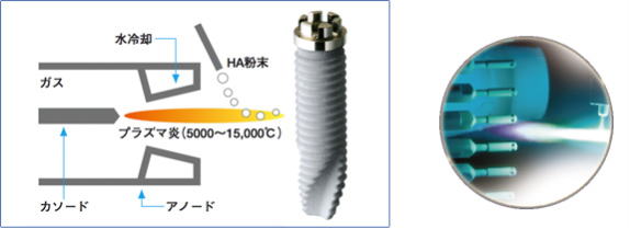 ＨＡコーティングインプラントのイメージ