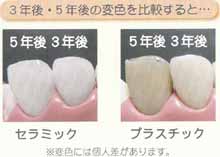 ３年後・５年後の変色を比較すると