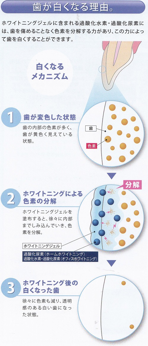 歯が白くなる理由