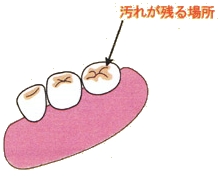 汚れが残る場所