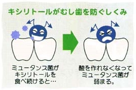 キシリトールがむし歯を防ぐしくみ