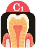 C1