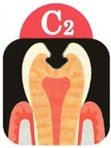 C2