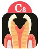 C3