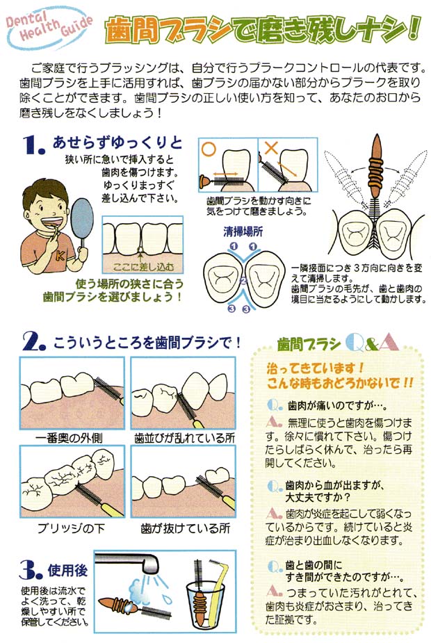 歯間ブラシで磨き残しなし